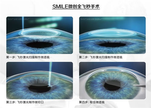 眼科謠言，你的“好心轉(zhuǎn)載”辦了多少壞事